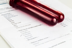 blood sample in test tubes with health analysis sc 2023 11 27 05 04 23 utc scaled