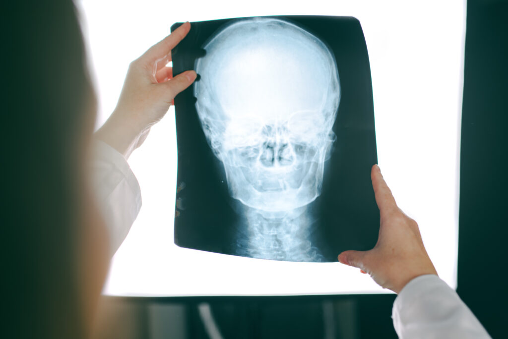 female doctor looking at x ray image of human head 2023 11 27 04 56 09 utc scaled