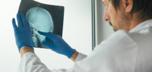 doctor examining x ray of the skull 2023 11 27 05 17 57 utc scaled